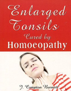 Enlarged Tonsils Cured by Homeopathy